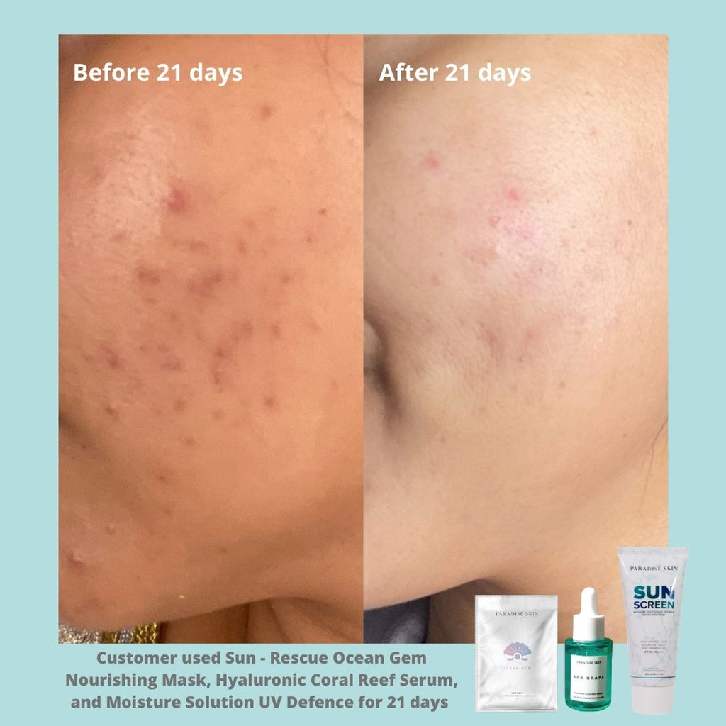 Hyaluronic Coral Reef Serum