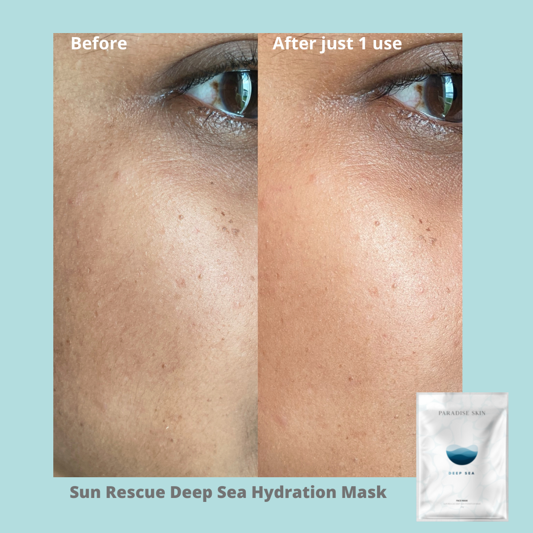 SUN RESCUE -  DEEP SEA HYDRATION MASK  -  4pack