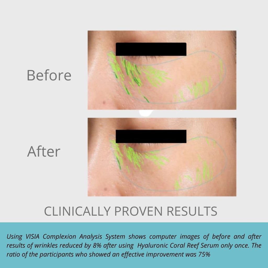 Hyaluronic Coral Reef Serum